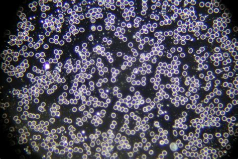 Dark field microscopy – electrosmog exposure visible during blood analysis - Switch Up Life