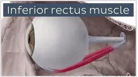 Inferior Rectus Muscle - Origin, Insertion, Function - Mobile Physio