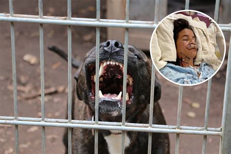'I Was Severely Attacked by a Pit Bull, I'd Never Own One' - Newsweek