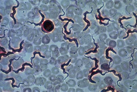 LM of blood infected with parasitic protozoans - Stock Image - M260/0172 - Science Photo Library