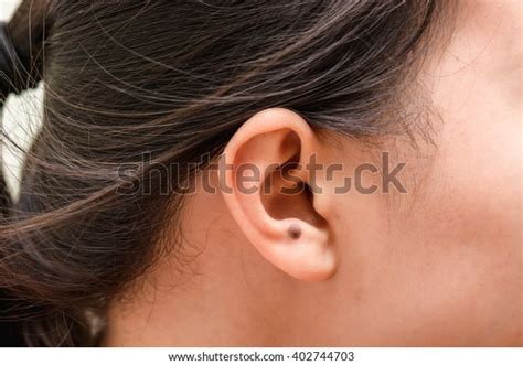 Birthmark On Ear Stock Photo 402744703 | Shutterstock