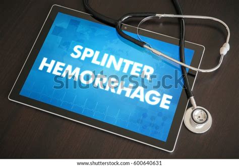 Splinter Hemorrhage Cutaneous Disease Diagnosis Medical Stock Photo 600640631 | Shutterstock