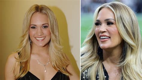 Carrie Underwood plastic surgery: what has she had done? | HELLO!