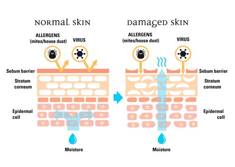 WHY DO YOU HAVE A SKIN BARRIER | Skin, Tretinoin, Damaged skin