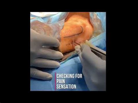 Sural Nerve Biopsy - YouTube