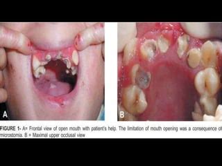 Mucocutaneous | PPT