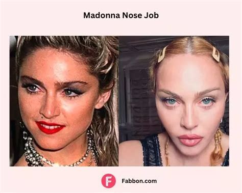 Madonna Plastic Surgery Secrets - Revealed | Fabbon