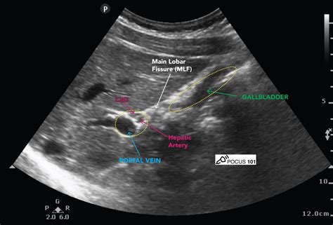 Abdominal Ultrasound Made Easy: Step-By-Step Guide - POCUS 101 | Ultrasound, Diagnostic medical ...