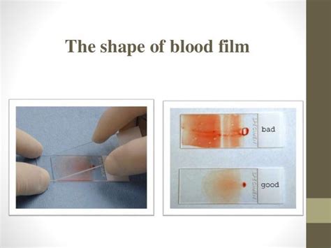 Blood smear staining