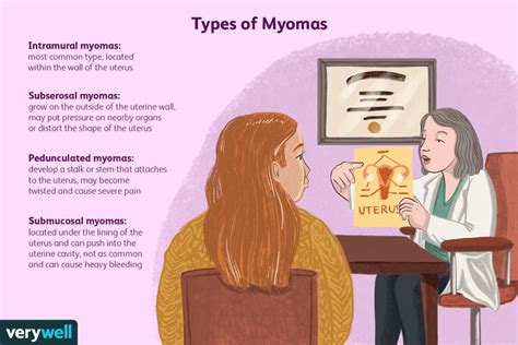 Myoma Signs and Symptoms