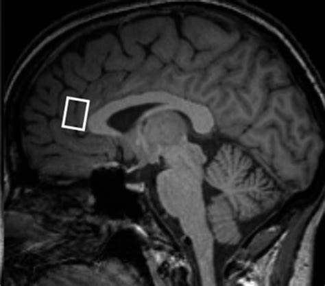 1H-MRS of the anterior cingulate cortex in obsessive-compulsive disorder: metabolic ...