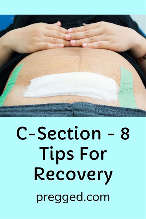 8 Helpful C-section Recovery Tips. Because C-sections are so common we ...