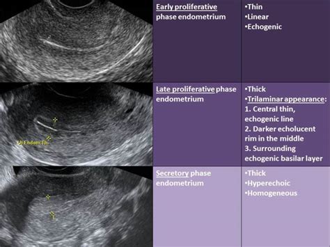 The Normal Menstrual Cycle and the Control of Ovulation - Endotext ...