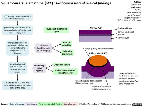 Squamous Cell Carcinoma (SCC) | Calgary Guide