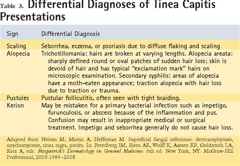 Tinea Capitis Treatment