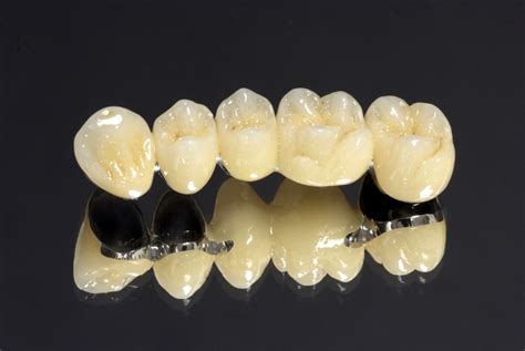 Full ceramic & Half Ceramic crowns | Dr. Nechupadam Dental Clinic