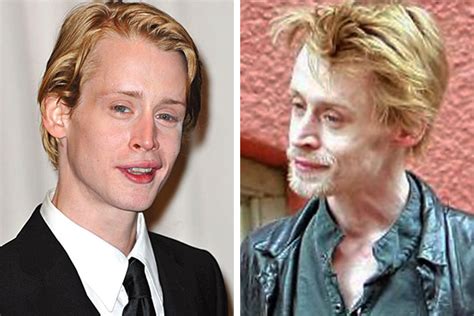 You Won’t Believe These Photos of 20 Celebrities Before and After Drugs ...