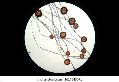 Rhizopus Sp Under Microscope High Power Stock Photo 1617345085 | Shutterstock