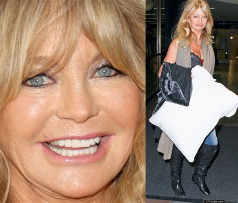 Pin on Goldie Hawn Plastic Surgery