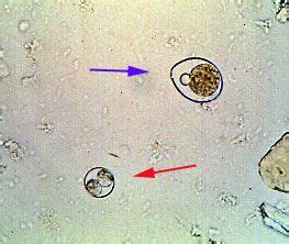 Cystoisospora spp - Dog | Dogs