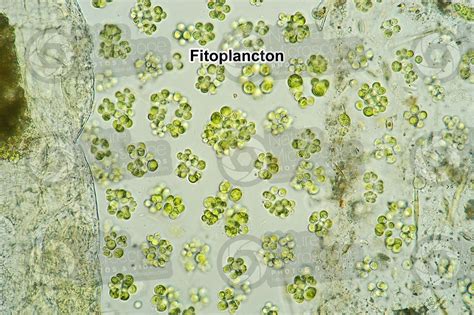 Fitoplancton. 200X - Fitoplancton - Microbiologia - Istologia vegetale - Foto