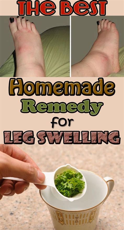 Prevent leg swelling and many other diseases with this amazing homemade ...