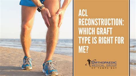 ACL Reconstruction: Which Graft Type is Right for Me? - OMG Tampa Bay