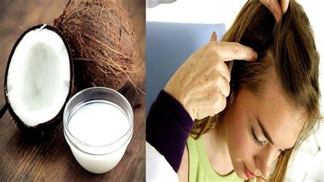 Can Coconut Oil Treat Scalp Psoriasis? - Healthy Living Daily