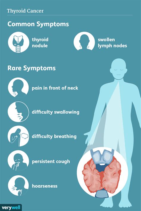 thyroid nodule symptoms - Wise Impressed
