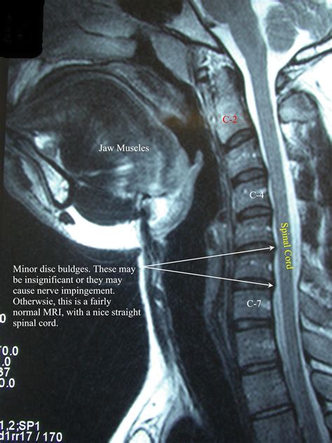 Pin on Mri Scans