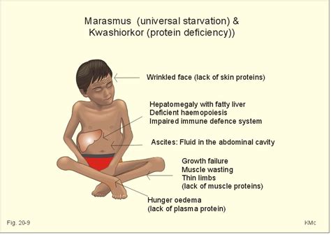 New Human Physiology Ch 20