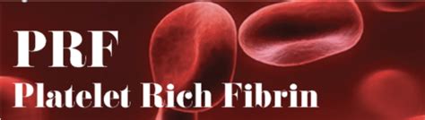 Torrance CA Platelet Rich Fibrin (PRF) for Oral Surgery | Palos Verdes