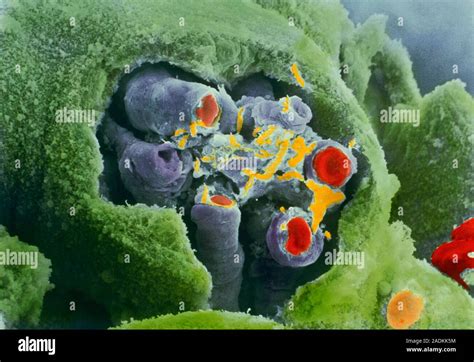 Placenta. Coloured scanning electron micrograph (SEM) of blood vessels ...