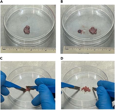 Mincing of human head and neck tumor tissue (A) Initial tumor sample.... | Download Scientific ...