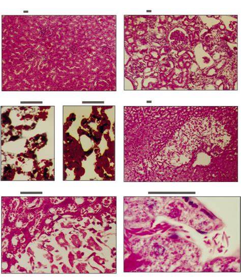 Sickle cell mouse organ histopathology. (A) Wild-type kidney (cortex).... | Download Scientific ...