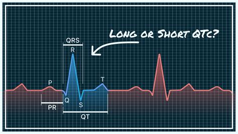 QTc Interval on Your Watch ECG - Short, Normal, and Prolonged | Qaly