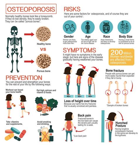 Osteoporosis Treatment in Jackson & Madison, MS