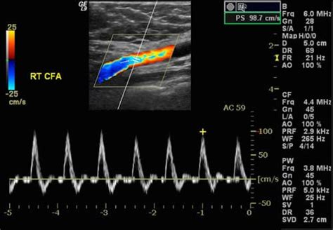 Arterial & Venous Doppler Ultrasound | K & T Diagnostic, Inc.