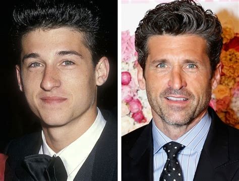 Patrick Dempsey Nose Job