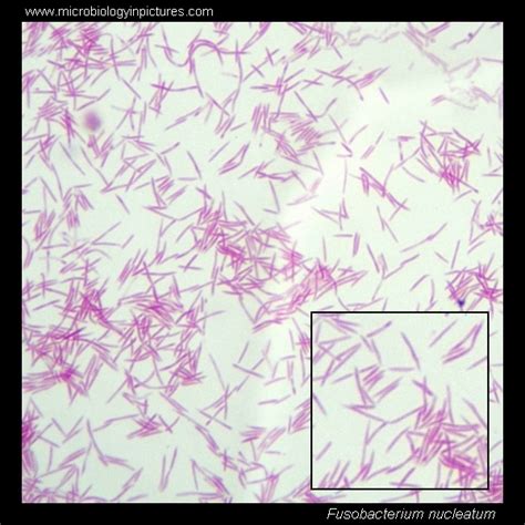 Fusobacterium nucleatum. Gram stain and cell morphology. Fusobacterium ...