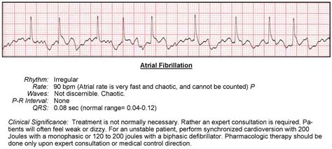 Atrial Fibrillation Rate