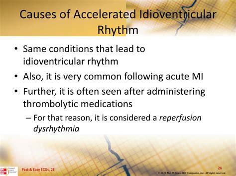 PPT - Ventricular Dysrhythmias PowerPoint Presentation, free download ...