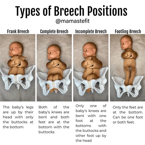 How To Turn Breech Baby