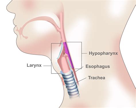 What is Hypopharyngeal Cancer? | Cancer Specialists in Arizona