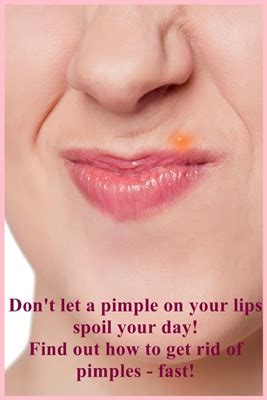 How To Treat Lip Pimples | Helpful Skincare Advice