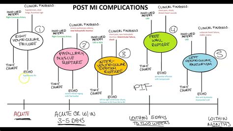 Post MI Complications - YouTube