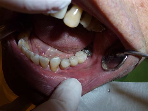 Implant Dentistry Dentist · Free photo on Pixabay