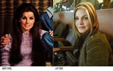 Priscilla Presley Before and After Plastic Surgery - ReelRundown