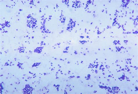 Free picture: photomicrograph, francisella, tularensis, bacteria, methylene, blue, stain