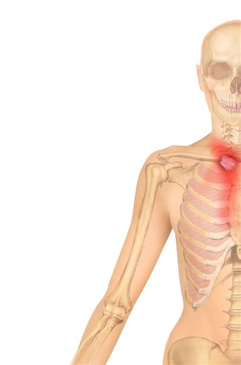 Ligament Pain Referral Patterns